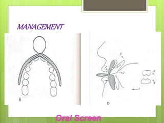 MANAGEMENT
Oral Screen
 