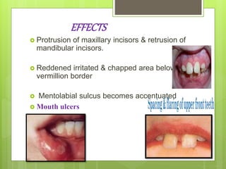 EFFECTS
 Protrusion of maxillary incisors & retrusion of
mandibular incisors.
 Reddened irritated & chapped area below the
vermillion border
 Mentolabial sulcus becomes accentuated
 Mouth ulcers
 