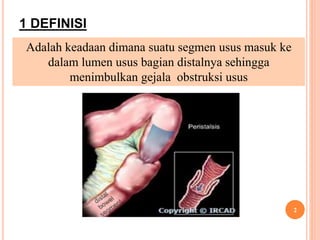 1 DEFINISI
2
Adalah keadaan dimana suatu segmen usus masuk ke
dalam lumen usus bagian distalnya sehingga
menimbulkan gejala obstruksi usus
 