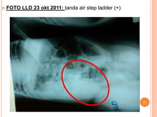  FOTO LLD 23 okt 2011: tanda air step ladder (+)
27
 