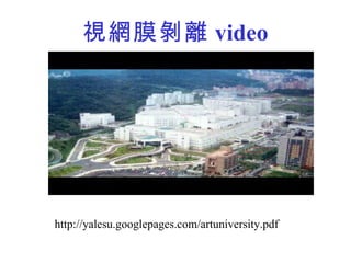 視網膜剝離 video http://yalesu.googlepages.com/artuniversity.pdf 