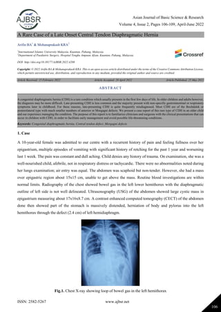Asian Journal of Basic Science & Research
Volume 4, Issue 2, Pages 106-109, April-June 2022
ISSN: 2582-5267 www.ajbsr.net
106
A Rare Case of a Late Onset Central Tendon Diaphragmatic Hernia
Arifin BA1
& Mohanaprakash KRA2
1
International Islamic University Malaysia, Kuantan, Pahang, Malaysia.
2
Department of Paediatric Surgery, Hospital Tengku Ampuan Afzan, Kuantan, Pahang, Malaysia.
DOI: http://doi.org/10.38177/AJBSR.2022.4208
Copyright: © 2022 Arifin BA & Mohanaprakash KRA. This is an open access article distributed under the terms of the Creative Commons Attribution License,
which permits unrestricted use, distribution, and reproduction in any medium, provided the original author and source are credited.
Article Received: 15 February 2022 Article Accepted: 20 April 2022 Article Published: 25 May 2022
1. Case
A 10-year-old female was admitted to our centre with a recurrent history of pain and feeling fullness over her
epigastrium, multiple episodes of vomiting with significant history of retching for the past 1 year and worsening
last 1 week. The pain was constant and dull aching. Child denies any history of trauma. On examination, she was a
well-nourished child, afebrile, not in respiratory distress or tachycardic. There were no abnormalities noted during
her lungs examination; air entry was equal. The abdomen was scaphoid but non-tender. However, she had a mass
over epigastric region about 15x15 cm, unable to get above the mass. Routine blood investigations are within
normal limits. Radiography of the chest showed bowel gas in the left lower hemithorax with the diaphragmatic
outline of left side is not well delineated. Ultrasonography (USG) of the abdomen showed large cystic mass in
epigastrium measuring about 17x16x8.7 cm. A contrast enhanced computed tomography (CECT) of the abdomen
done then showed part of the stomach is massively distended, herniation of body and pylorus into the left
hemithorax through the defect (2.4 cm) of left hemidiaphragm.
Fig.1. Chest X-ray showing loop of bowel gas in the left hemithorax
ABSTRACT
A congenital diaphragmatic hernia (CDH) is a rare condition which usually presents in the first few days of life. In older children and adults however,
the diagnosis may be more difficult. Late-presenting CDH is less common and the majority present with non-specific gastrointestinal or respiratory
symptoms later in childhood. For these reasons, late-presenting CDH is quite frequently misdiagnosed. Most CDH are of the Bochdalek or
posterolateral type with much smaller numbers of anterior or Morgagni defects. We present a case report of this rare type of CDH in an older child
and our experience managing the condition. The purpose of this report is to familiarize clinicians and surgeons with the clinical presentations that can
occur in children with CDH, in order to facilitate early management and avoid possible life-threatening conditions.
Keywords: Congenital diaphragmatic hernia, Central tendon defect, Morgagni defects.
 