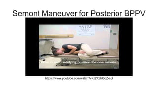 Semont R Bppv Vestibular Rehabilitation | PDF