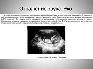 Отражение звука. Эхо.
 