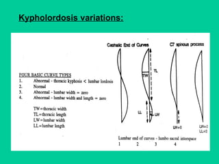 Kypholordosis variations:
 
