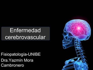 Enfermedad
cerebrovascular
Fisiopatología-UNIBE
Dra.Yazmín Mora
Cambronero
 