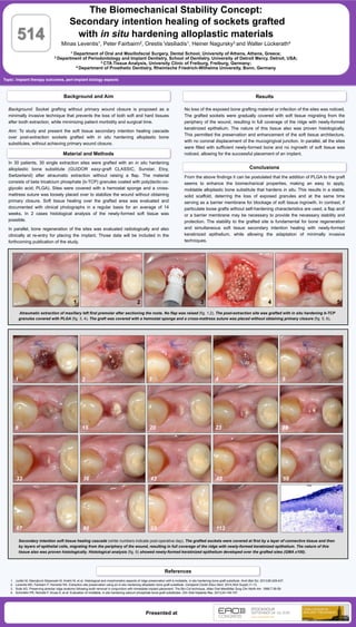 Background: Socket grafting without primary wound closure is proposed as a
minimally invasive technique that prevents the loss of both soft and hard tissues
after tooth extraction, while minimizing patient morbidity and surgical time.
Aim: To study and present the soft tissue secondary intention healing cascade
over post-extraction sockets grafted with in situ hardening alloplastic bone
substitutes, without achieving primary wound closure.
In 30 patients, 30 single extraction sites were grafted with an in situ hardening
alloplastic bone substitute (GUIDOR easy-graft CLASSIC, Sunstar, Etoy,
Switzerland) after atraumatic extraction without raising a flap. The material
consists of beta tricalcium phosphate (b-TCP) granules coated with poly(lactic-co-
glycolic acid; PLGA). Sites were covered with a hemostat sponge and a cross-
mattress suture was loosely placed over to stabilize the wound without obtaining
primary closure. Soft tissue healing over the grafted area was evaluated and
documented with clinical photographs in a regular basis for an average of 14
weeks. In 2 cases histological analysis of the newly-formed soft tissue was
possible.
In parallel, bone regeneration of the sites was evaluated radiologically and also
clinically at re-entry for placing the implant. Those data will be included in the
forthcoming publication of the study.
Atraumatic extraction of maxillary left first premolar after sectioning the roots. No flap was raised (fig. 1,2). The post-extraction site was grafted with in situ hardening b-TCP
granules covered with PLGA (fig. 3, 4). The graft was covered with a hemostat sponge and a cross-mattress suture was placed without obtaining primary closure (fig. 5, 6).
Material and Methods
Topic: Implant therapy outcomes, peri-implant biology aspects
The Biomechanical Stability Concept:
Secondary intention healing of sockets grafted
with in situ hardening alloplastic materials
Minas Leventis1, Peter Fairbairn2, Orestis Vasiliadis1, Heiner Nagursky3 and Walter Lückerath4
1 Department of Oral and Maxillofacial Surgery, Dental School, University of Athens, Athens, Greece;
2 Department of Periodontology and Implant Dentistry, School of Dentistry, University of Detroit Mercy, Detroit, USA;
3 CTA Tissue Analysis, University Clinic of Freiburg, Freiburg, Germany;
4 Department of Prosthetic Dentistry, Rheinische Friedrich-Wilhelms University, Bonn, Germany
514
References
Conclusions
1.  Jurišić M, Manojlović-Stojanoski M, Andrić M, et al. Histological and morphometric aspects of ridge preservation with a moldable, in situ hardening bone graft substitute. Arch Biol Sci. 2013;65:429-437.
2.  Leventis MD, Fairbairn P, Horowitz RA. Extraction site preservation using an in-situ hardening alloplastic bone graft substitute. Compend Contin Educ Dent. 2014;35(4 Suppl):11-13.
3.  Sclar AG. Preserving alveolar ridge anatomy following tooth removal in conjunction with immediate implant placement. The Bio-Col technique. Atlas Oral Maxillofac Surg Clin North Am. 1999;7:39-59.
4.  Schmidlin PR, Nicholls F, Kruse A, et al. Evaluation of moldable, in situ hardening calcium phosphate bone graft substitutes. Clin Oral Implants Res. 2013;24:149-157.
Background and Aim Results
Presented at
No loss of the exposed bone grafting material or infection of the sites was noticed.
The grafted sockets were gradually covered with soft tissue migrating from the
periphery of the wound, resulting in full coverage of the ridge with newly-formed
keratinized epithelium. The nature of this tissue also was proven histologically.
This permitted the preservation and enhancement of the soft tissue architecture,
with no coronal displacement of the mucogingival junction. In parallel, all the sites
were filled with sufficient newly-formed bone and no ingrowth of soft tissue was
noticed, allowing for the successful placement of an implant.
From the above findings it can be postulated that the addition of PLGA to the graft
seems to enhance the biomechanical properties, making an easy to apply,
moldable alloplastic bone substitute that hardens in situ. This results in a stable,
solid scaffold, deterring the loss of exposed granules and at the same time
serving as a barrier membrane for blockage of soft tissue ingrowth. In contrast, if
particulate loose grafts without self-hardening characteristics are used, a flap and/
or a barrier membrane may be necessary to provide the necessary stability and
protection. The stability to the grafted site is fundamental for bone regeneration
and simultaneous soft tissue secondary intention healing with newly-formed
keratinized epithelium, while allowing the adaptation of minimally invasive
techniques.
Secondary intention soft tissue healing cascade (white numbers indicate post-operative day). The grafted sockets were covered at first by a layer of connective tissue and then
by layers of epithelial cells, migrating from the periphery of the wound, resulting in full coverage of the ridge with newly-formed keratinized epithelium. The nature of this
tissue also was proven histologically. Histological analysis (fig. 6) showed newly-formed keratinized epithelium developed over the grafted sites (GMA x100).
1 2 3 4 5
1 2 3 4 5
6 15 20 23 28
33 36 43 48 59
67 80 93 113 6
 