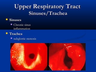 Upper Respiratory Tract
                    Sinuses/Trachea
   Sinuses
       Chronic sinus
        inflammation
   Trachea
       subglottic stenosis
 