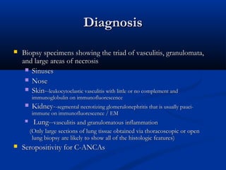Diagnosis
   Biopsy specimens showing the triad of vasculitis, granulomata,
    and large areas of necrosis
      Sinuses
      Nose
      Skin--leukocytoclastic vasculitis with little or no complement and
         immunoglobulin on immunofluorescence
        Kidney--segmental necrotizing glomerulonephritis that is usually pauci-
         immune on immunofluorescence / EM
         Lung--vasculitis and granulomatous inflammation
         (Only large sections of lung tissue obtained via thoracoscopic or open
          lung biopsy are likely to show all of the histologic features)
   Seropositivity for C-ANCAs
 