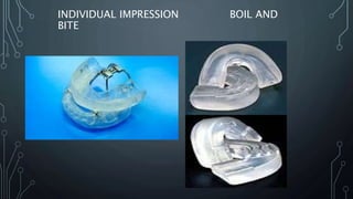 Dental management of sleep apnea | PPTX
