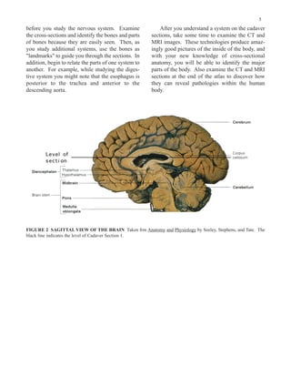 Miniatlas of Human Cross-Sectional Anatomy | PDF