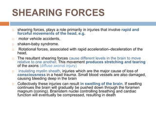 Sheering Injuries 9 Acquired-brain-injury.pdf