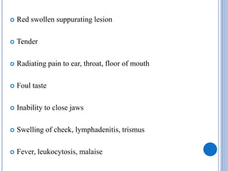  Red swollen suppurating lesion
 Tender
 Radiating pain to ear, throat, floor of mouth
 Foul taste
 Inability to close jaws
 Swelling of cheek, lymphadenitis, trismus
 Fever, leukocytosis, malaise
 