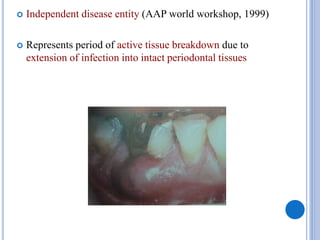  Independent disease entity (AAP world workshop, 1999)
 Represents period of active tissue breakdown due to
extension of infection into intact periodontal tissues
 