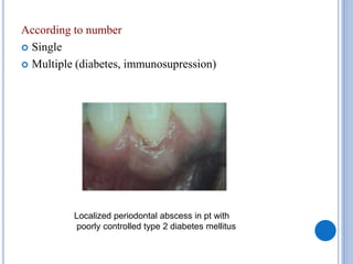 According to number
 Single
 Multiple (diabetes, immunosupression)
Localized periodontal abscess in pt with
poorly controlled type 2 diabetes mellitus
 
