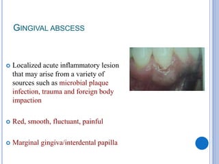 GINGIVAL ABSCESS
 Localized acute inflammatory lesion
that may arise from a variety of
sources such as microbial plaque
infection, trauma and foreign body
impaction
 Red, smooth, fluctuant, painful
 Marginal gingiva/interdental papilla
 