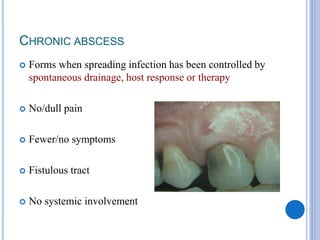 CHRONIC ABSCESS
 Forms when spreading infection has been controlled by
spontaneous drainage, host response or therapy
 No/dull pain
 Fewer/no symptoms
 Fistulous tract
 No systemic involvement
 