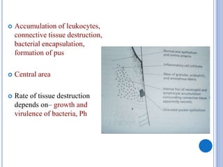  Accumulation of leukocytes,
connective tissue destruction,
bacterial encapsulation,
formation of pus
 Central area
 Rate of tissue destruction
depends on– growth and
virulence of bacteria, Ph
 