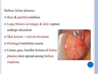 Bullous lichen plannus:
 Rare & painful condition
 Large blisters on tongue & skin- rupture
undergo ulceration
 Skin lesions + oral involvement
 Prolonged indefinite course
 Linear, grey, lacelike lesions of lichen
plannus inter-spread among bullous
eruptions
 