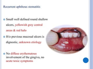 Recurrent aphthous stomatitis
 Small well defined round shallow
ulcers, yellowish grey central
areas & red halo
 H/o previous mucosal ulcers is
dignostic, unknown etiology
 No diffuse erythematous
involvement of the gingiva, no
acute toxic symptoms
 