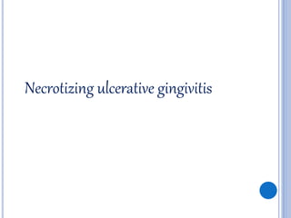 Necrotizing ulcerative gingivitis
 