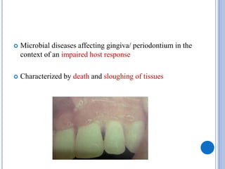  Microbial diseases affecting gingiva/ periodontium in the
context of an impaired host response
 Characterized by death and sloughing of tissues
 