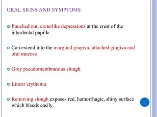 ORAL SIGNS AND SYMPTOMS
 Punched out, craterlike depressions at the crest of the
interdental papilla
 Can extend into the marginal gingiva, attached gingiva and
oral mucosa
 Grey pseudomembranous slough
 Linear erythema
 Removing slough exposes red, hemorrhagic, shiny surface
which bleeds easily
 