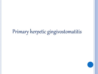Primary herpetic gingivostomatitis
 