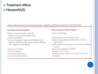  Treatment differs
 Herpes/NUG
 