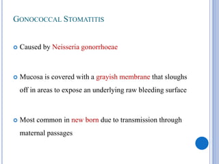 GONOCOCCAL STOMATITIS
 Caused by Neisseria gonorrhoeae
 Mucosa is covered with a grayish membrane that sloughs
off in areas to expose an underlying raw bleeding surface
 Most common in new born due to transmission through
maternal passages
 