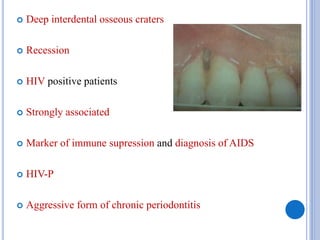  Deep interdental osseous craters
 Recession
 HIV positive patients
 Strongly associated
 Marker of immune supression and diagnosis of AIDS
 HIV-P
 Aggressive form of chronic periodontitis
 
