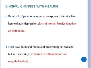 GINGIVAL CHANGES WITH HEALING
 Removal of pseudo membrane – exposes red crater like
hemorrhagic depression.(loss of normal barrier function
of epithelium)
 Next day: Bulk and redness of crater margins reduced –
but surface shiny.(reduction in inflammation and
reepithelization)
 