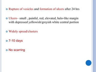  Rupture of vesicles and formation of ulcers after 24 hrs
 Ulcers– small , painful, red, elevated, halo-like margin
with depressed yellowish/greyish white central portion
 Widely spread/clusters
 7-10 days
 No scarring
 