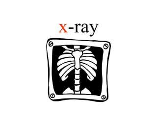 x-ray