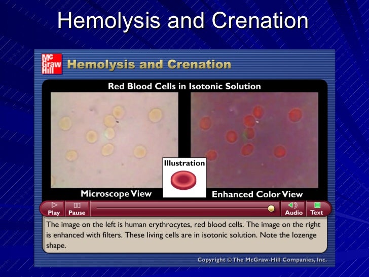 What are hemolysis and crenation?