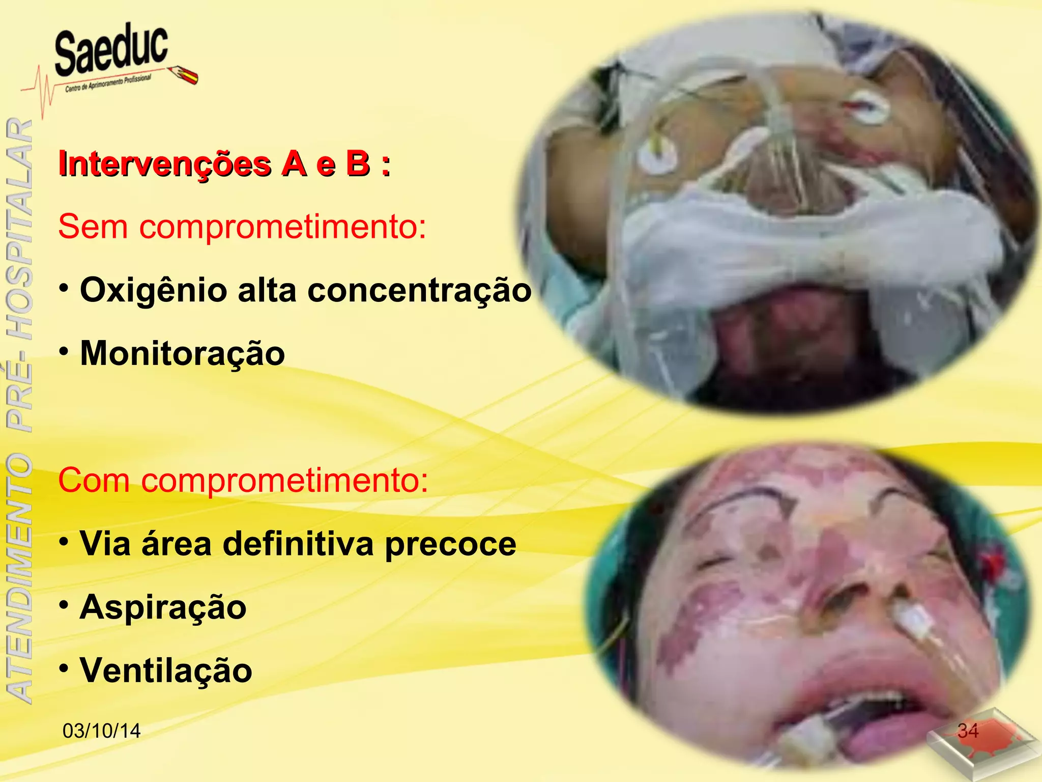 Intervenções A e B :Intervenções A e B :
Sem comprometimento:
• Oxigênio alta concentração
• Monitoração
Com comprometimento:
• Via área definitiva precoce
• Aspiração
• Ventilação
03/10/14 34
 