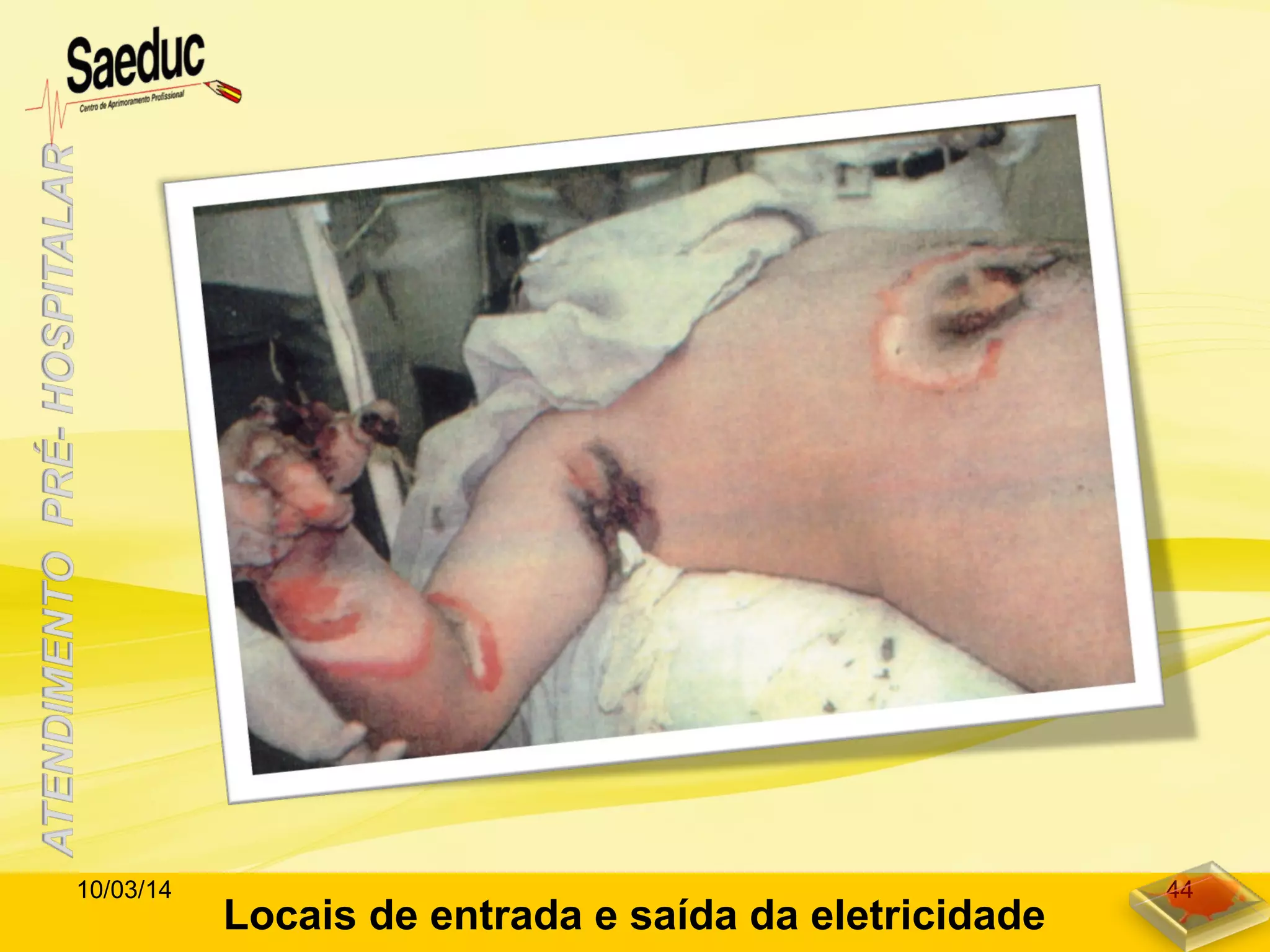 Locais de entrada e saída da eletricidade
10/03/14 44
 