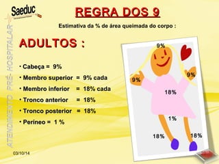 Estimativa da % de área queimada do corpo :
ADULTOS :ADULTOS :
• CabeçaCabeça = 9%
• Membro superiorMembro superior = 9% cada
• Membro inferiorMembro inferior = 18% cada
• Tronco anteriorTronco anterior = 18%
• Tronco posteriorTronco posterior = 18%
• PeríneoPeríneo = 1 %
9%
9%
18%18%
9%
18%
1%
REGRA DOS 9REGRA DOS 9
03/10/14 20
 