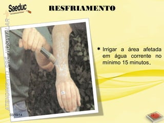  Irrigar a área afetada
em água corrente no
mínimo 15 minutos.
RESFRIAMENTO
03/10/14 29
 