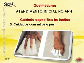 Cuidado específico às lesõesCuidado específico às lesões
3. Cuidados com mãos e pés
QueimadurasQueimaduras
ATENDIMENTO INICIAL NO APH
03/10/14 40
 