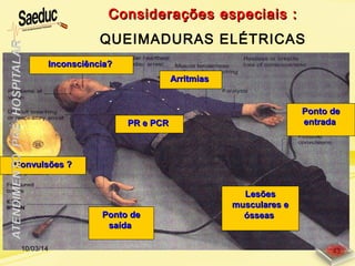 Convulsões ?Convulsões ?
Considerações especiais :Considerações especiais :
QUEIMADURAS ELÉTRICAS
Ponto dePonto de
entradaentrada
Ponto dePonto de
saídasaída
Inconsciência?Inconsciência?
LesõesLesões
musculares emusculares e
ósseasósseas
PR e PCRPR e PCR
ArritmiasArritmias
10/03/14 43
 