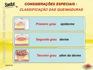 CONSIDERAÇÕES ESPECIAIS :CONSIDERAÇÕES ESPECIAIS :
CLASSIFICAÇÃO DAS QUEIMADURAS
03/10/14 9
 
