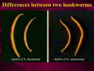 Differences between two hookworms
Adults of A. duodenale Adults of N. americanus
 