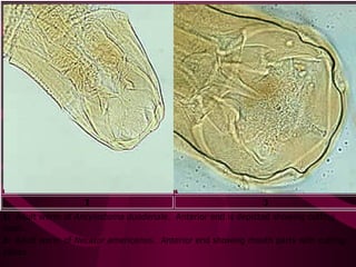I J
I: Adult worm of Ancylostoma duodenale. Anterior end is depicted showing cutting
teeth.
J: Adult worm of Necator americanus. Anterior end showing mouth parts with cutting
plates.
 