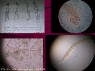 Filariform of Necator americanus pointed tail
 