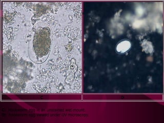 C D
C: Hookworm egg in an unstained wet mount.
D: hookworm egg viewed under UV microscopy.
 
