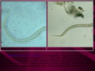 E F
E, F: Rhabditiform (L1) larvae (wet preparation). They hatch from eggs are
250-300 µm long and approximately 15-20 µm wide. They have a long buccal canal and
an inconspicuous genital primordium. Rhabditiform larvae are usually not found in stool,
but may be found there is a delay in processing the stool specimen. If larvae are seen in
stool, they must be differentiated from the L1 larvae of Stronyloides stercoralis.
 