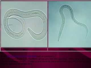 G H
G, H: Filariform (L3) larvae(wet preparation).
Infective, third-stage (L3), filariform larvae are 500-600 µm long. They have a pointed
tail and a striated sheath. These L3 are found in the environment and infect the human
host by penetration of the skin.
 