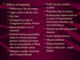 • Effects of anaemia
– Pallor-eyes, lips & tongue
– Light yellow and dry skin
– Dry hair
– Enlarged liver due to
Congestive Cardiac Failure
– Heart murmurs coz of
anaemia.
– Protein loosing enteropathy
leads to a drop in plasma
protein. Oedema develops
due to exacerbation of fluid
into extracellular space.
– Oedema (usually facial but
may be generalised)
– Puffy face & swollen
eyelids
– Potbellies due to ascites
– Koilonychia (spoon nails as
a result of hypochromic
microcytic anaemia, esp
iron deficiency)
– Stunted growth and general
malaise
– Acute mental distress
– Mental dullness
– Delayed puberty
– Heavy infections – heart
failure
 