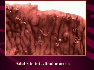Adults in intestinal mucosa
 